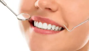 caries szakasz - tünetek és jelek a fogszuvasodás