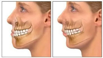 Costul de corectare muscatura de chirurgie, tratament stomatologic