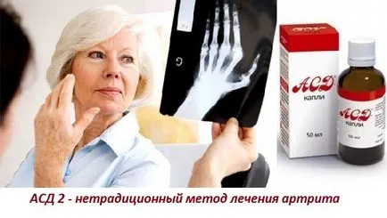 Az adagolási rend és az arthritis kezelésére frakció SDA 2