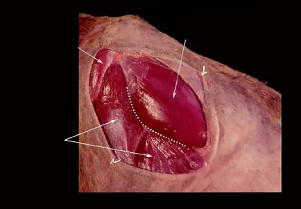 triplei osteotomii pelviene