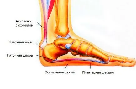 Heel sérülés és trauma tünetei és kezelése - különösen igaz az öregségi