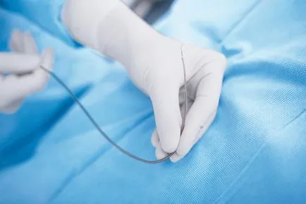 Tipuri de metode endoscopice de cercetare în chirurgie