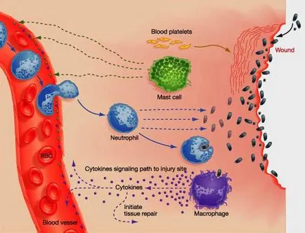 inflamaţia immuninfo