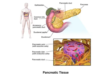 pancreas aberantă