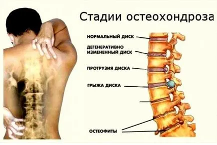 Болница ISC с рани