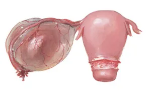 Кистата на яйчниците е опасно - последствия от заболяването, могат да се разтворят