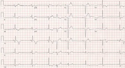 Amely képes detektálni az EKG és szív ultrahang