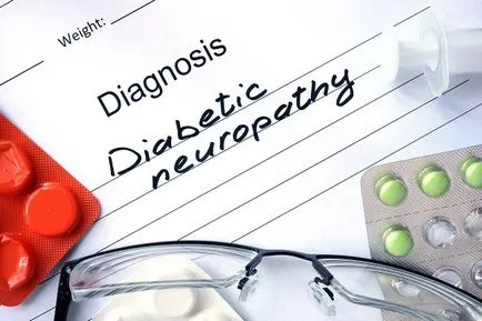 Diabetikus neuropátia tünetei és kezelése