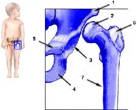 Хип дисплазия при деца и възрастни