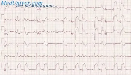 EKG funkcionális teszteket