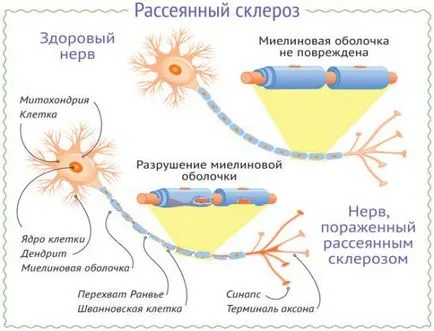 EEG vagy agyi MRI kontraszt, ami a legjobban