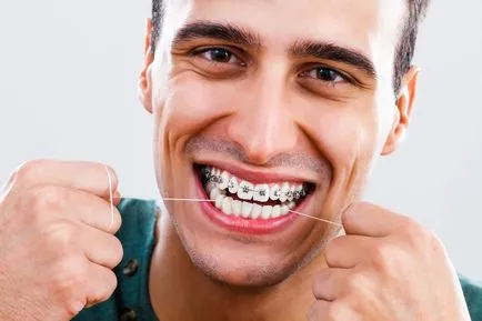 Cum se folosește ața dentară, utilizați paranteze ata