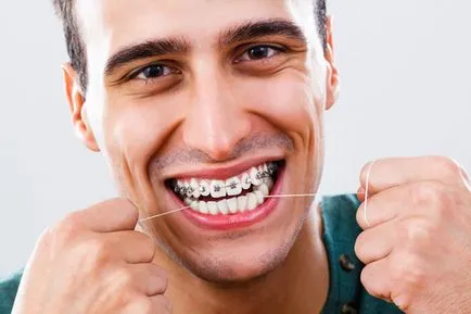 Hogyan kell használni a fogselymet fogszabályozó