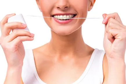 Hogyan kell használni a fogselymet fogszabályozó