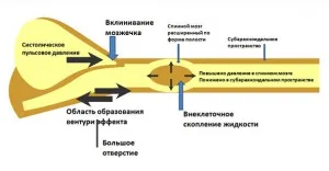 Chiari подобни малформации и сирингомиелия при кучета