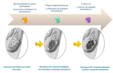 menopauzás tünetek