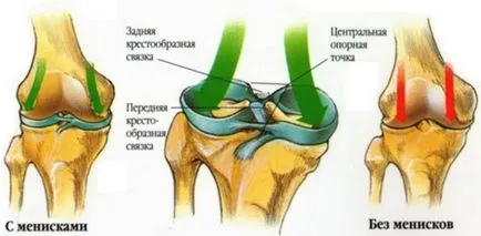 На менискуса на симптомите на коляното, лечението с операция и без