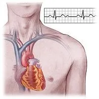 tulburări de ritm cardiac simptome și tratament