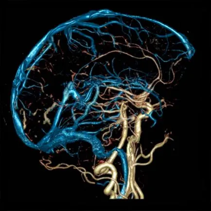 MRI az agyi erek Moszkva árak, angiográfia, a fej és az artériák és anélkül kontastom