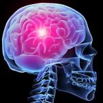 accident vascular cerebral simptome stem, prognostic, tratament, consecințe