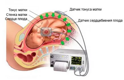 tonusul uterului în timpul sarcinii simptome, cauze, simptome, cum să eliminați