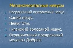 Висяща мола и техните причини