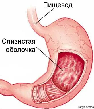 Хронична без атрофичен гастрит - отговори и съвети