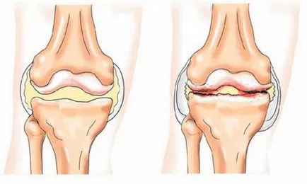 Beteg térd, amit orvos kezelése