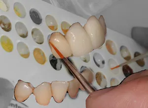 Зъботехническа лаборатория Стоматологична клиника