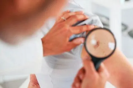 17 din Regulamentul de produse de îngrijire a pielii, care aderă la dermatologi