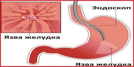 стомашни болки - как да премахнете бързо у дома, диагностика на заболявания и наркотици