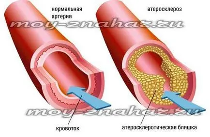 Cât de subțire sângele în casă rapid și eficient