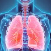 tuberculoză pulmonară Ciroză ce este, cauze si tratament