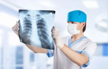 tuberculoză pulmonară Ciroză ce este, cauze si tratament