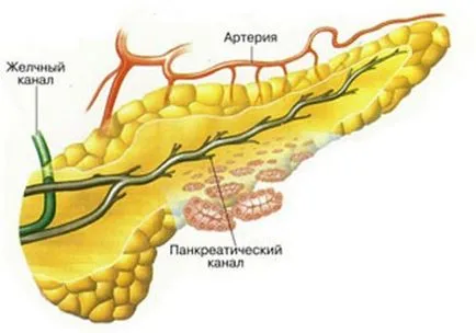 A destruktív pancreatitis mi ez, és hogyan kell kezelni pancreatitis