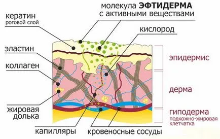 Eftiderm - gyulladásos komponenst