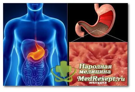 Gyomorhurut, magas savtartalma - egy komplex kóros folyamatok a gyomorban és diagnózis