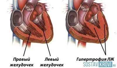 ritmul cardiac de frontieră la adulți, copii, tipuri de frontiere, monotonie cardiacă, tratament