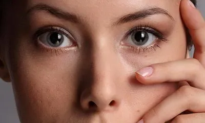 Hogyan lehet eltávolítani a duzzanatokat a szem alatt