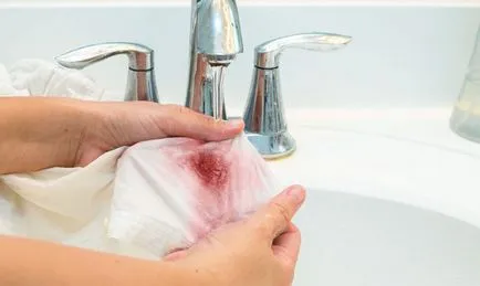 Hogyan mossa a fehér cucc - Tippek háziasszonyok