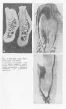 Alveoláris csontszövet az állkapocs, a periodontális betegség és a periodontitis, periodontális betegségek kezelésére