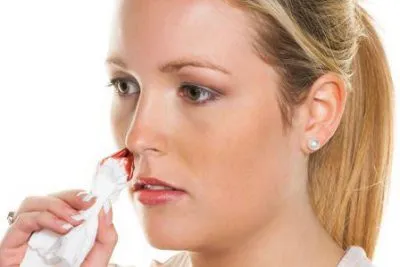 Кървенето от носа предизвиква при възрастни, защо и какво, типове и първа помощ