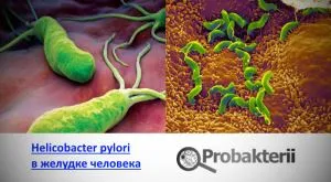 Лечение на Helicobacter бактерии в стомаха, които причиняват язви, рак на стомаха народната медицина
