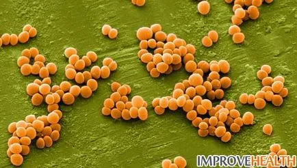 Fertőzések kezelésére okozta Staphylococcus aureus a bélben a gyerekek