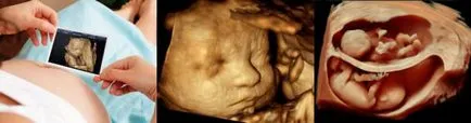 3D terhességi ultrahang, 4D - ha ez jobban csinálni