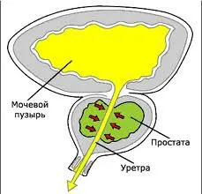 Лимфни възли с простатит - простатит симптоми и лечението