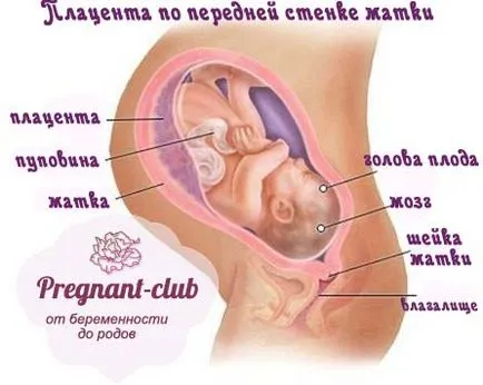 placentă atașament scăzut pe peretele frontal, placenta