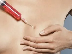 подмладяване на кожата и лазерно разцепване на гърдата, традиционните методи