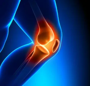 Poszttraumás artrózis a térdízület, a kezelés, a jelek, tünetek