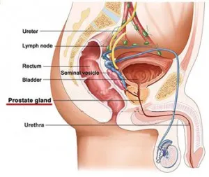 Prostatita, o consultare on-line urolog, androlog